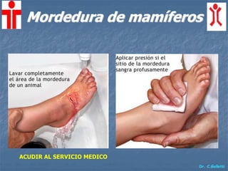 Dr. C.Galletti
Mordedura de mamíferos
ACUDIR AL SERVICIO MEDICO
 