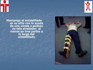 Mantenga el entablillado
en su sitio con la ayuda
de una venda o pedazo
de tela alrededor, al
menos en tres partes a
lo largo del
entablillado
 