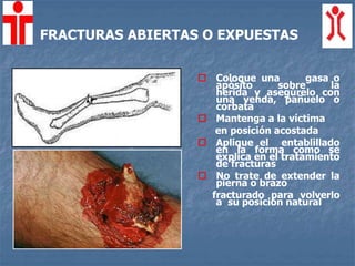FRACTURAS ABIERTAS O EXPUESTAS
 Coloque una gasa o
apósito sobre la
herida y asegúrelo con
una venda, pañuelo o
corbata
 Mantenga a la víctima
en posición acostada
 Aplique el entablillado
en la forma como se
explica en el tratamiento
de fracturas
 No trate de extender la
pierna o brazo
fracturado para volverlo
a su posición natural
 