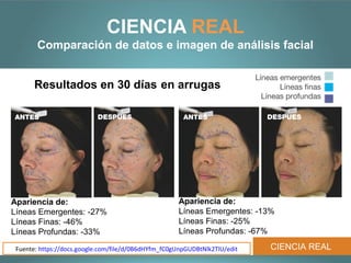 CIENCIA REAL
        Comparación de datos e imagen de análisis facial

                                                                            Líneas emergentes
       Resultados en 30 días en arrugas                                            Líneas finas
                                                                              Líneas profundas

ANTES                      DESPUES                     ANTES                   DESPUES




Apariencia de:                                       Apariencia de:
Líneas Emergentes: -27%                              Líneas Emergentes: -13%
Líneas Finas: -46%                                   Líneas Finas: -25%
Líneas Profundas: -33%                               Líneas Profundas: -67%

 Fuente: https://docs.google.com/file/d/0B6dHYfm_fC0gUnpGUDBtNlk2TlU/edit       CIENCIA REAL
 