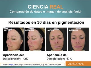 CIENCIA REAL
       Comparación de datos e imagen de análisis facial


      Resultados en 30 días en pigmentación
ANTES                      DESPUES                     ANTES                DESPUES




Apariencia de:                                        Apariencia de:
Descoloración: -42%                                   Descoloración: -67%
Fuente: https://docs.google.com/file/d/0B6dHYfm_fC0gUnpGUDBtNlk2TlU/edit   CIENCIA REAL
 