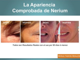 La Apariencia
        Comprobada de Nerium

ANTES             DESPUES              ANTES                DESPUES




        Todos son Resultados Reales con el uso por 90 días ó menos




                                                        RESULTADOS REALES
 