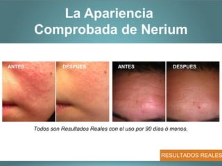 La Apariencia
        Comprobada de Nerium

ANTES              DESPUES              ANTES                DESPUES




        Todos son Resultados Reales con el uso por 90 días ó menos.



                                                        RESULTADOS REALES
 