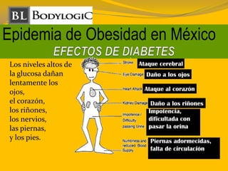Epidemia de Obesidad en México
Los niveles altos de
la glucosa dañan
lentamente los
ojos,
el corazón,
los riñones,
los nervios,
las piernas,
y los pies.
Ataque cerebral
Daño a los ojos
Ataque al corazón
Daño a los riñones
Impotencia,
dificultada con
pasar la orina
Piernas adormecidas,
falta de circulación
 
