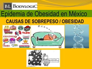 Epidemia de Obesidad en México
CAUSAS DE SOBREPESO / OBESIDAD
 