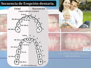 Elija el cepillo más adecuado a su boca, su odontólogo le aconsejara el más indicado y no deje de renovarlo cada tres meses. 