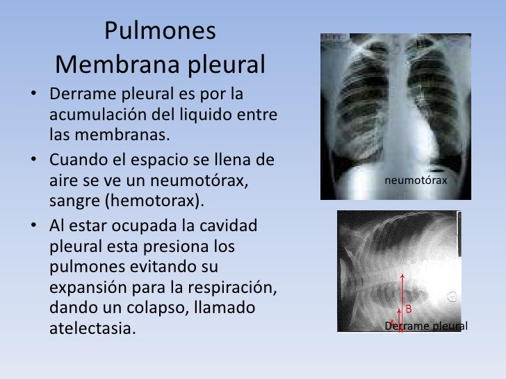 cuando se llena de agua los pulmones