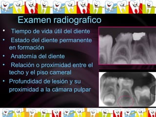 Tiempo de vida útil del diente  Estado del diente permanente en formación  Anatomía del diente  Relación o proximidad entre el techo y el piso cameral  Profundidad de lesión y su proximidad a la cámara pulpar   