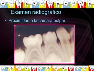 Proximidad a la cámara pulpar   