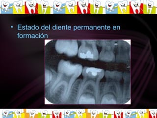 Estado del diente permanente en formación  
