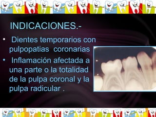 Dientes temporarios con pulpopatias  coronarias  Inflamación afectada a una parte o la totalidad de la pulpa coronal y la pulpa radicular . 