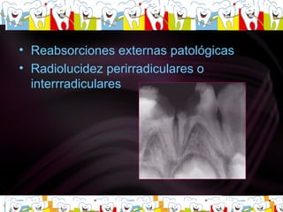Reabsorciones externas patológicas  Radiolucidez perirradiculares o interrradiculares 