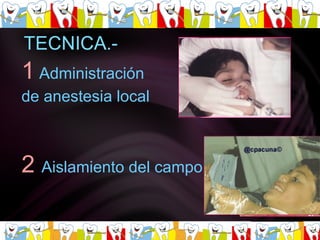 1   Administración  de anestesia local   2   Aislamiento del campo operatorio 