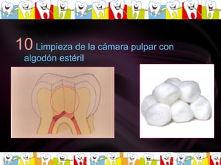 10   Limpieza de la cámara pulpar con algodón estéril   