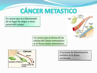 Es cáncer que se a diseminado
de su lugar de origen a otras
partes del cuerpo.
Un tumor que se forma de las
células del cáncer metastático
se le llama tumor metastático.
Al proceso de diseminación
también se le llama
metástasis.
 