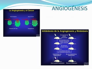 ANGIOGÉNESIS
 
