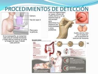 PROCEDIMIENTOS DE DETECCIÓN
 