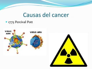 Causas del cancer
 1775 Percival Pott
 