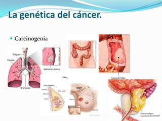 La genética del cáncer.
 Carcinogenia
 