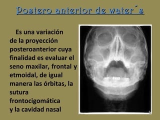 Postero anterior de water´sPostero anterior de water´s
Es una variación
de la proyección
posteroanterior cuya
finalidad es evaluar el
seno maxilar, frontal y
etmoidal, de igual
manera las órbitas, la
sutura
frontocigomática
y la cavidad nasal
 
