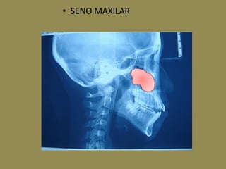 • SENO MAXILAR
 