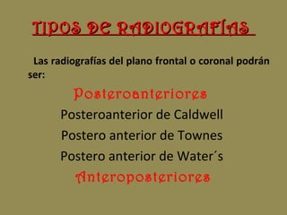 TIPOS DE RADIOGRAFÍASTIPOS DE RADIOGRAFÍAS
Las radiografías del plano frontal o coronal podrán
ser:
Posteroanteriores
Posteroanterior de Caldwell
Postero anterior de Townes
Postero anterior de Water´s
Anteroposteriores
 