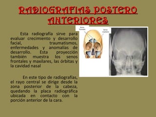 RADIOGRAFIAS POSTERORADIOGRAFIAS POSTERO
ANTERIORESANTERIORES
Esta radiografía sirve para
evaluar crecimiento y desarrollo
facial, traumatismos,
enfermedades y anomalías de
desarrollo. Esta proyección
también muestra los senos
frontales y maxilares, las órbitas y
la cavidad nasal
En este tipo de radiografías,
el rayo central se dirige desde la
zona posterior de la cabeza,
quedando la placa radiográfica
ubicada en contacto con la
porción anterior de la cara.
Senos
frontales Senos
maxilares
 