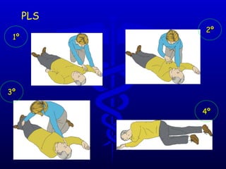 PLS 1º 3º 4º 2º 