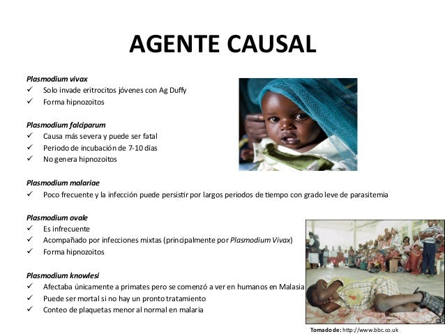 Presentación respuesta inmune a malaria Presentación respuesta inmune a malaria