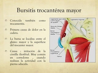 Bursitis trocantérea mayor Conocida también como trocanteritis. Primera causa de dolor en la cadera. La bursa se localiza entre el gluteo mayor y la superficie del trocanter mayor. Causa : irritación de la cintilla iliotibial. Muy común en corredores , cuando realizan la actividad con la pierna aducida.  