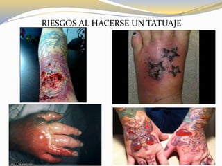 RIESGOS AL HACERSE UN TATUAJE
 