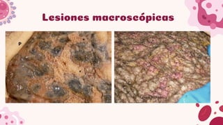 Comprehensive Overview of Rumen and Reticulum Pathologies in Domestic ...