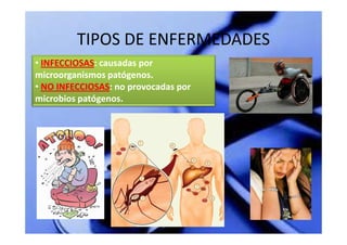 TIPOS DE ENFERMEDADES
• INFECCIOSAS: causadas por
  INFECCIOSAS:
microorganismos patógenos.
• NO INFECCIOSAS: no provocadas por
     INFECCIOSAS:
microbios patógenos.
 