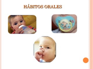 HÁBITOS ORALES 