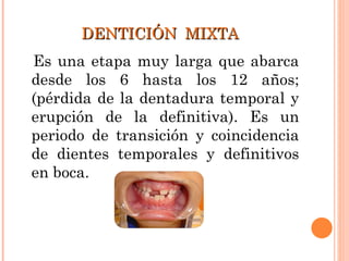 DENTICIÓN  MIXTA Es una etapa muy larga que abarca desde los 6 hasta los 12 años; (pérdida de la dentadura temporal y erupción de la definitiva). Es un periodo de transición y coincidencia de dientes temporales y definitivos en boca.  