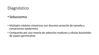 Diagnóstico
• Sebaceoma
• Múltiples nódulos simetricos con discreta variación de tamaño y
compromiso epidermico
• Compuesto por una mezcla de sebocitos maduros y células basaloides
de aspect germinativo
 