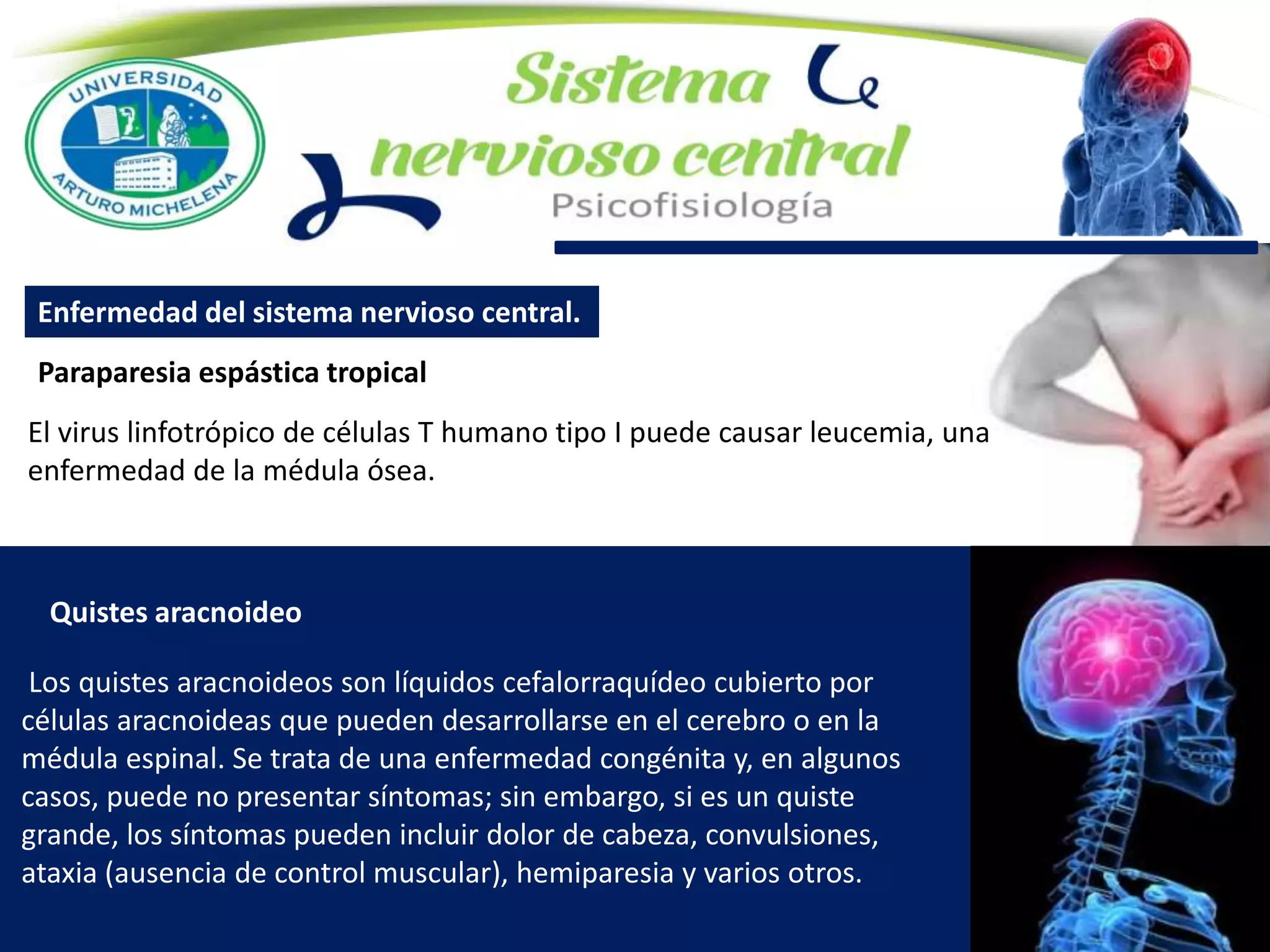 Paraparesia espástica tropical
Enfermedad del sistema nervioso central.
El virus linfotrópico de células T humano tipo I puede causar leucemia, una
enfermedad de la médula ósea.
Quistes aracnoideo
Los quistes aracnoideos son líquidos cefalorraquídeo cubierto por
células aracnoideas que pueden desarrollarse en el cerebro o en la
médula espinal. Se trata de una enfermedad congénita y, en algunos
casos, puede no presentar síntomas; sin embargo, si es un quiste
grande, los síntomas pueden incluir dolor de cabeza, convulsiones,
ataxia (ausencia de control muscular), hemiparesia y varios otros.
 