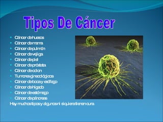 Cáncer de huesos Cáncer de mama Cáncer de pulmón Cáncer de vejiga Cáncer de piel Cáncer de próstata Cáncer de colon Tumores ginecológicos Cáncer de boca y esófago Cáncer de hígado Cáncer de estómago Cáncer de páncreas Hay muchos tipos y algunos ni siquiera tienen cura  Tipos De Cáncer 