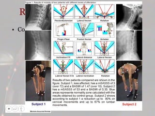 Resultados Comparativa 