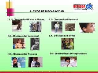 5.- TIPOS DE DISCAPACIDAD. 5.6.- Enfermedades Discapacitantes 5.5.- Discapacidad Psíquica 5.4.- Discapacidad Mental 5.3.- Discapacidad Intelectual 5.2.- Discapacidad Sensorial 5.1.- Discapacidad Física o Motora. 