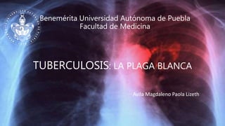 Benemérita Universidad Autónoma de Puebla
Facultad de Medicina
TUBERCULOSIS: LA PLAGA BLANCA
Avila Magdaleno Paola Lizeth
 