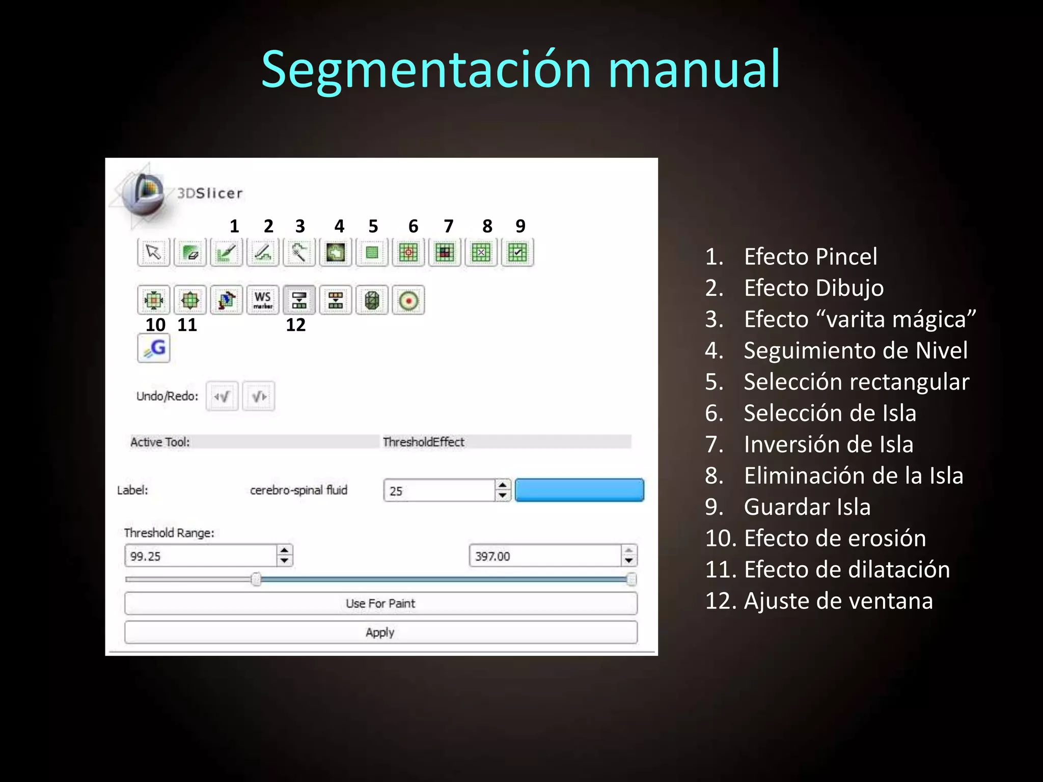 Segmentación manual
1. Efecto Pincel
2. Efecto Dibujo
3. Efecto “varita mágica”
4. Seguimiento de Nivel
5. Selección rectangular
6. Selección de Isla
7. Inversión de Isla
8. Eliminación de la Isla
9. Guardar Isla
10. Efecto de erosión
11. Efecto de dilatación
12. Ajuste de ventana
1 2 3 4 5 6 7 8 9
10 11 12
 