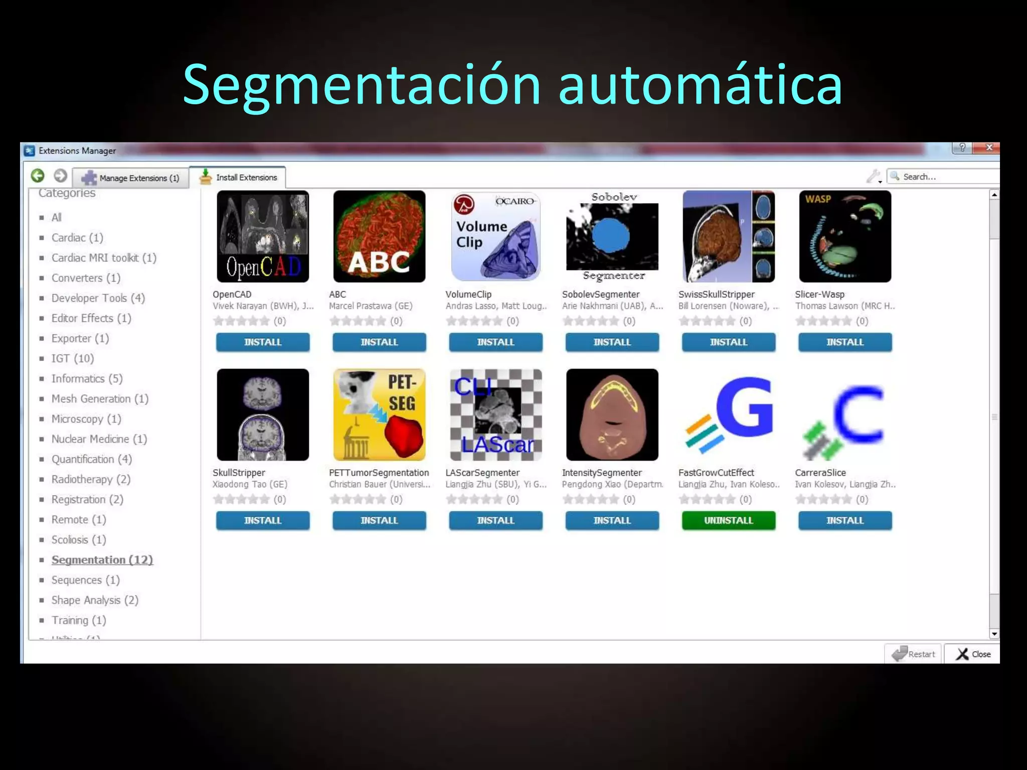 Segmentación automática
 
