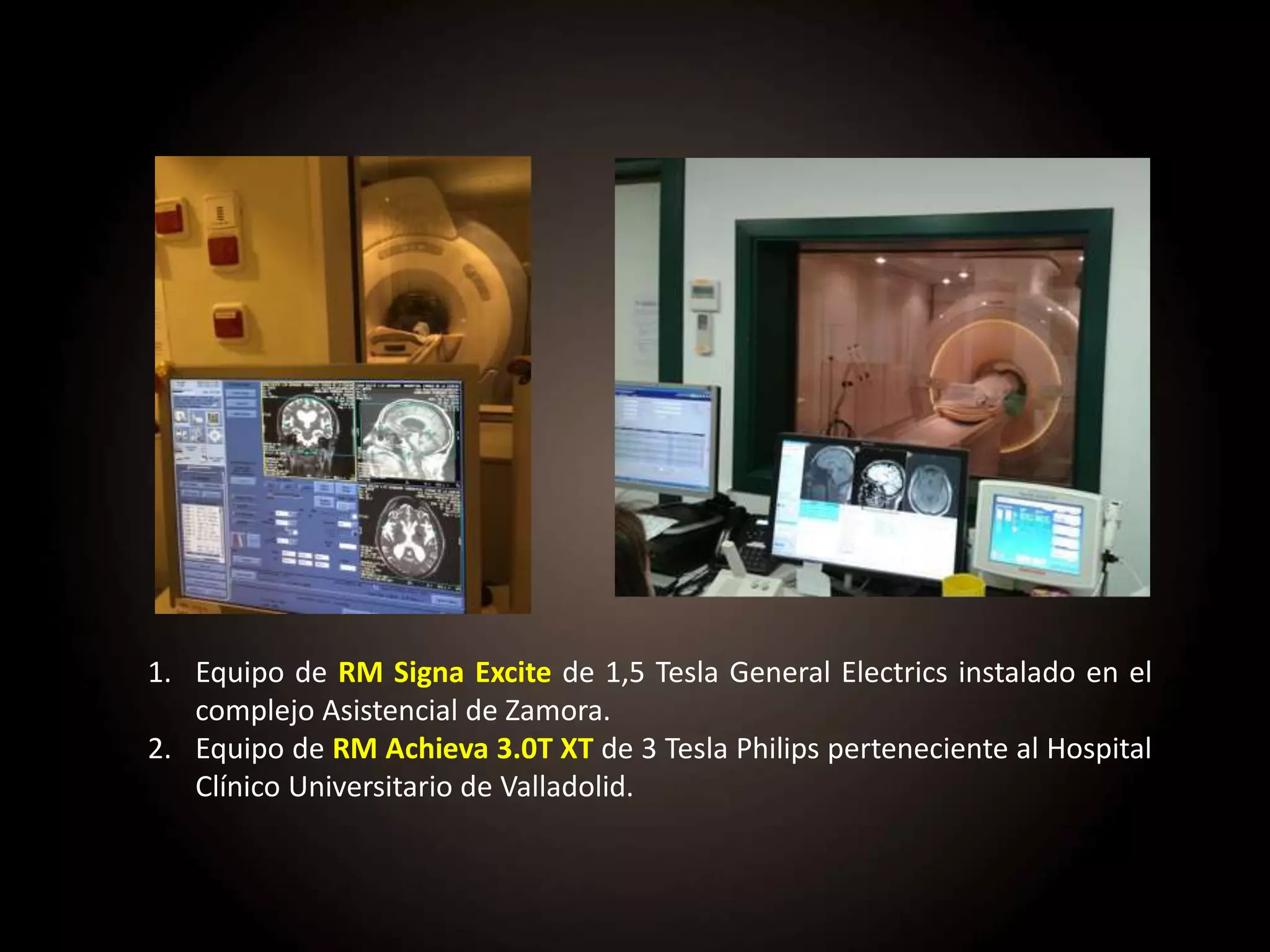 1. Equipo de RM Signa Excite de 1,5 Tesla General Electrics instalado en el
complejo Asistencial de Zamora.
2. Equipo de RM Achieva 3.0T XT de 3 Tesla Philips perteneciente al Hospital
Clínico Universitario de Valladolid.
 