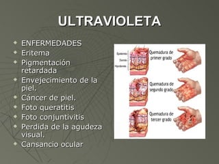 ULTRAVIOLETA
   ENFERMEDADES
   Eritema
   Pigmentación
    retardada
   Envejecimiento de la
    piel.
   Cáncer de piel.
   Foto queratitis
   Foto conjuntivitis
   Perdida de la agudeza
    visual.
   Cansancio ocular
 