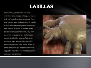 LADILLAS
Las ladillas o piojos púbicos son unos
molestos y pequeños parásitos que se clavan
en la piel para alimentarse de sangre. Viven
en el vello corporal, especialmente en el vello
púbico, aunque también pueden encontrarse
en el vello de las axilas, la cara o el pecho.
Los piojos son de color amarillo-gris y usan
sus pinzas para agarrarse a las hebras de
cabello. Las ladillas se pasan fácilmente
durante el sexo, pero también se pueden
pasar compartiendo ropa, toallas o ropa de
cama con alguien que las tiene. Las ladillas
no pueden trasmitirse por medio de asientos
de inodoro o en piscinas.
 