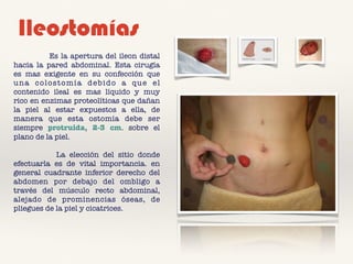 Ileostomías
Es la apertura del ileon distal
hacia la pared abdominal. Esta cirugía
es mas exigente en su confección que
una colostomía debido a que el
contenido ileal es mas líquido y muy
rico en enzimas proteolíticas que dañan
la piel al estar expuestos a ella, de
manera que esta ostomía debe ser
siempre protruida, 2-3 cm. sobre el
plano de la piel.
La elección del sitio donde
efectuarla es de vital importancia. en
general cuadrante inferior derecho del
abdomen por debajo del ombligo a
través del músculo recto abdominal,
alejado de prominencias óseas, de
pliegues de la piel y cicatrices.
 