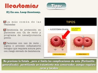 Ileostomías Tipos
D) En asa. Loop ileostomy.
L a m á s c o m ú n d e l a s
realizadas
Ileostomía de protección en
pacientes con Ca de recto y
programa de neoadyuvancia
previo
Pacientes con neo de recto ,
sigma o proceso inﬂamatorio
benigno que requiera sutura pero
con riesgo elevado de desistencia
No previene la fístula , pero sí limita las complicaciones de esta (Peritonitis
generalizada) permitiendo un tratamiento más conservador, aunque requiere
curas y lavados
 