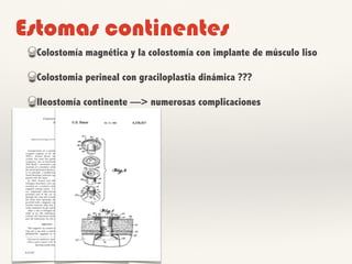 Estomas continentes
Colostomía magnética y la colostomía con implante de músculo liso
Colostomia perineal con graciloplastia dinámica ???
Ileostomía continente —> numerosas complicaciones
 