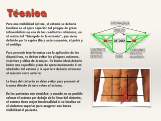 Para una visibilidad óptima, el estoma se debería
localizar en el ápice superior del pliegue de grasa
infraumbilical en uno de los cuadrantes inferiores, en
el centro del “triángulo de la ostomía”, que viene
definido por la espina ilíaca anterosuperior, el pubis y
el ombligo.
Para prevenir interferencias con la aplicación de los
dispositivos, se deben evitar los pliegues cutáneos,
cicatrices y sitios de drenajes. De forma ideal,debería
haber una superficie plana de aproximadamente 6 cm
alrededor del estoma y la apertura debería atravesar
el músculo recto anterior
La línea del cinturón se debe evitar para prevenir el
trauma directo de este sobre el estoma.
En los pacientes con obesidad, y cuando no es posible
colocar el estoma por debajo de la línea del cinturón,
el estoma tiene mejor funcionalidad si se localiza en
el abdomen superior para asegurar una buena
visibilidad al paciente.
Técnica
 